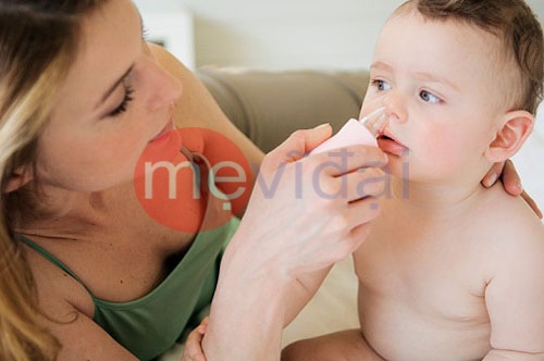 Bí quyết chữa sổ mũi cho bé bằng phương pháp dân gian hiệu quả nhanh khỏi