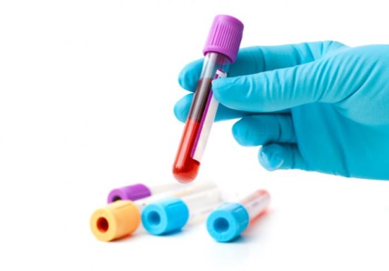 Xét nghiệm Anti HBs dương tính có bị viêm gan B?